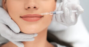 Lip Filler on female patient