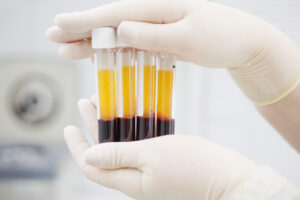 blood and plasma separated in tube